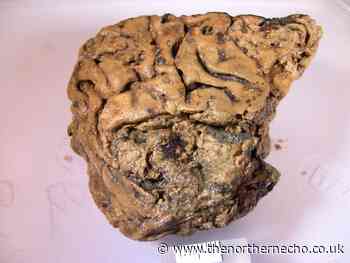 Iron Age brain was preserved in York skull