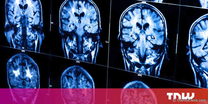 Scientists may have found the missing link between brain matter and consciousness