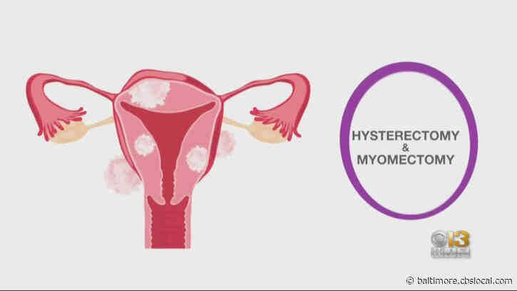 Northwest Hospital Offering Innovative Treatment To Eliminate Fibroids