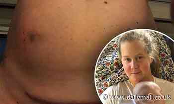 Amy Schumer, 38, reveals she is undergoing IVF