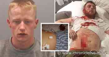 Stab victim shares horrific picture of his injuries after being attacked on night out in Newcastle