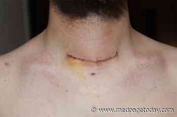 Post-Thyroidectomy Hypocalcemia and Magnesium Disorder Go Hand-in-Hand