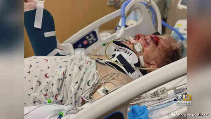 ‘Like Someone Pummeled Him’: Pedestrian Hit By Truck Near Towson Town Center Dies