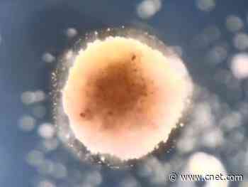 Living robots made from frog embryo cells could swim inside your body     - CNET