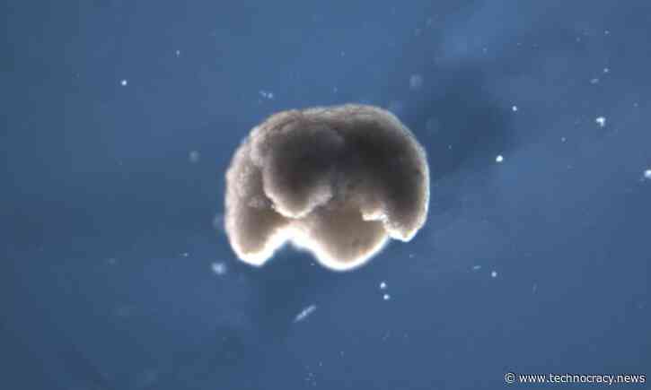 ‘Xenobots’: Scientists Use Stem Cells To Create First Living Robots