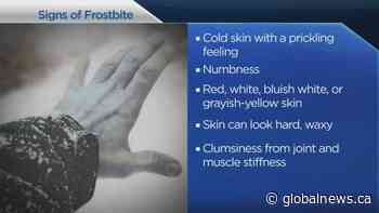 Recognizing the signs of frostbite and hypothermia