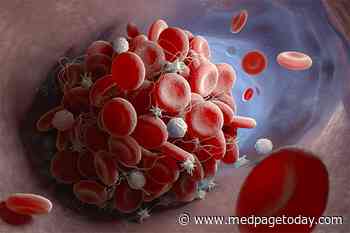 Metabolic Syndrome Linked With VTE Recurrence