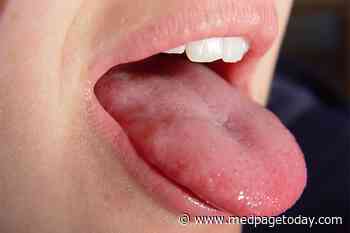 Sleep Apnea and Weight Loss: A Concentrated Effect?
