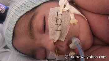 Baby’s parents could face life-support court battle without help from lawyers