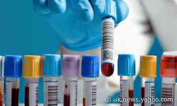 Sepsis deaths around world 'twice as high as previously thought'
