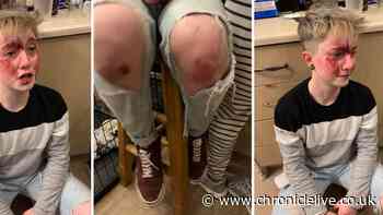 Young woman subjected to vile homophobic attack in Sunderland