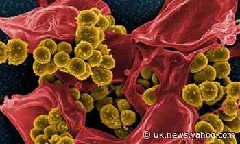 Cannabis compound could be weapon in fight against superbugs