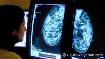 Magnetised molecules used to monitor breast cancer