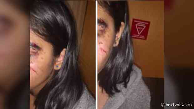 'I can't stop thinking about what happened': Traumatized B.C. teen speaks out after alleged assault