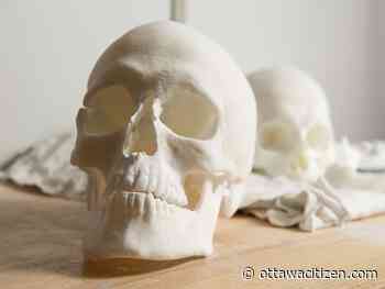 To find the identities of dead people, NRC starts with the skull