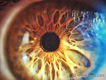 Dry eyes, eye strain, blurry vision: 8 common eye symptoms and what they mean     - CNET