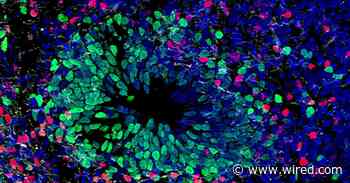 How to Be Humane to a Lab-Grown Brain