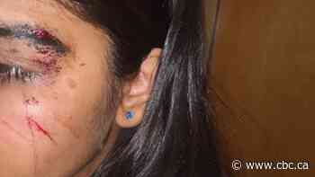 A girl, 14, was allegedly assaulted. Her mother says Coquitlam RCMP pressured her not to pursue charges