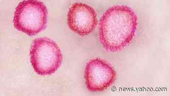 Coronavirus diagnosed in Chicago woman marks 2nd case, 5 total confirmed in US