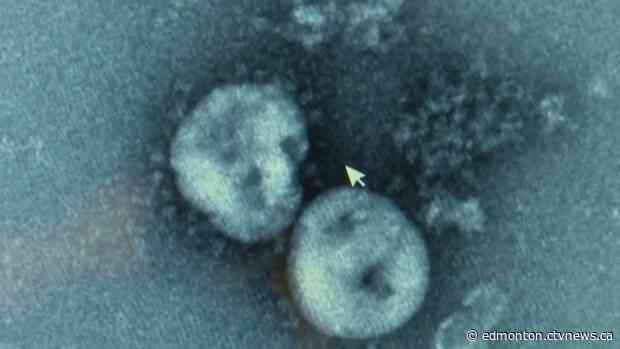 'No probable, no confirmed cases': Alberta remains free of coronavirus