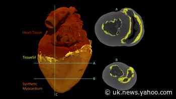 Engineers design bionic ‘heart’ that beats like the real thing