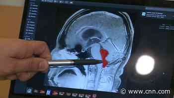 Man was sweating from severe pain.  See what CT scan revealed