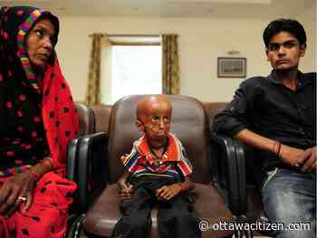 Understanding this rare disease could help treat aspects of aging