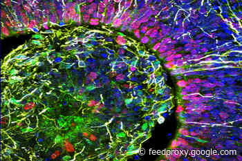 Brain Organoids are Farther From Consciousness Than You Might Think