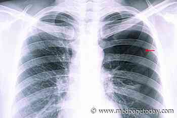 Watchful Waiting: An Option for Spontaneous Pneumothorax
