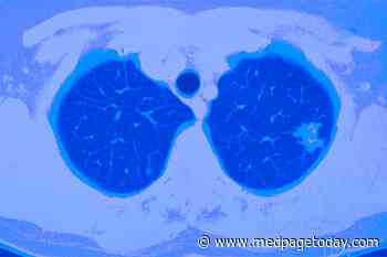 More Evidence to Support Lung Cancer Screening