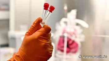Wer zahlt den Coronavirus-Test?