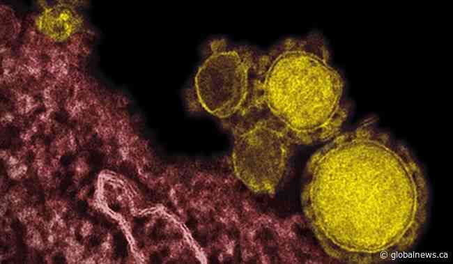 Man with coronavirus discharged from Toronto hospital - Global News