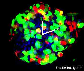 Resetting Our Internal Circadian Clocks May Help Control Diabetes