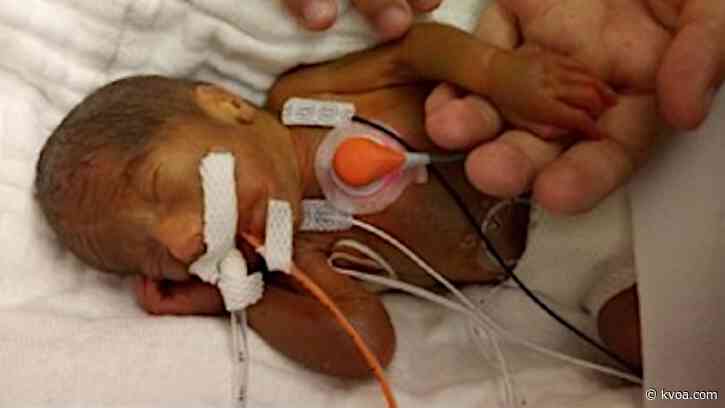 Family claims premature newborn burned by incubator at Phoenix hospital