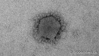 Alberta health officials have conducted 18 tests for coronavirus; no confirmed cases