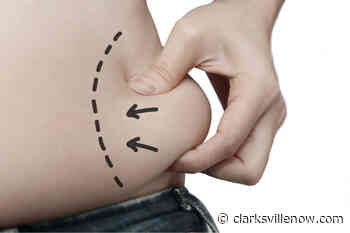 Lose stubborn fat with help from Bella Medical Spa in Clarksville - Clarksville Now