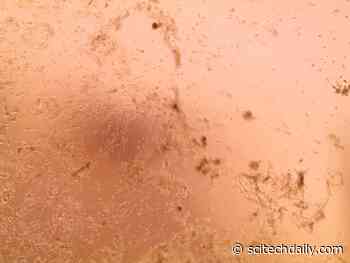 Strains of Coronavirus 2019-nCoV Detected in France Isolated