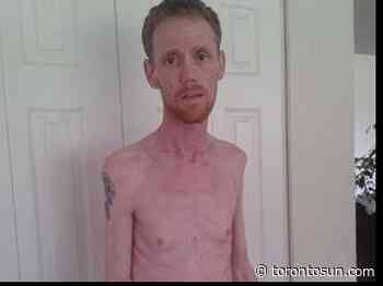 HUNTER: Killer's sex attack survivor has died a thousand deaths - Toronto Sun