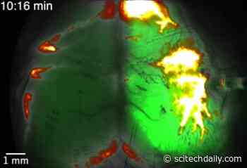 Watch a Brain Drown in Its Own Fluid After a Stroke