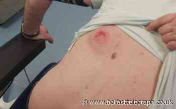 Drug dealers in fear after gun attack on Belfast republican Pat Fitzpatrick - Belfast Telegraph