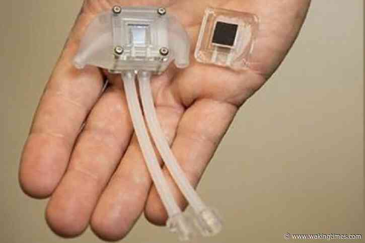 A Bio-Artificial Kidney Is Being Developed To End The Need For Dialysis