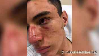 Buenos Aires: un rugbier sufrió una brutal golpiza y sugirió que hubo "ensañamiento" por el crimen de Fernando - Misiones OnLine