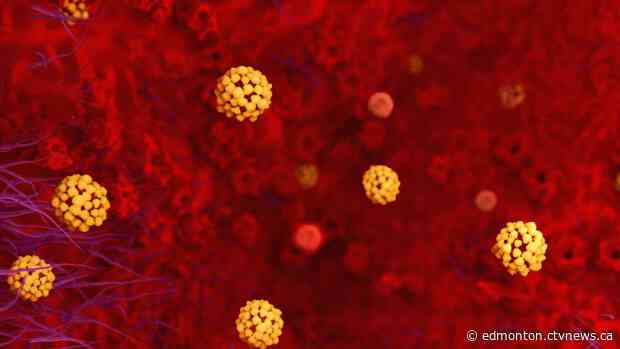 Still no coronavirus in Alberta; province 'ready to respond' if needed