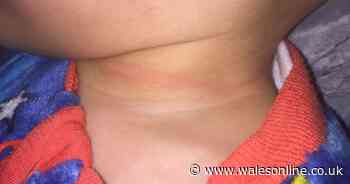 Mum an 'emotional wreck' after finding string from Aldi bedding wrapped around  one-year-old's neck