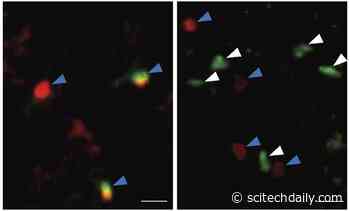 Revitalizing the Aging Brain by Activating Immune Cells