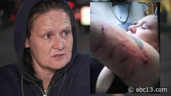 Fatal pit bull dog attack survivor remembers horror - KTRK-TV