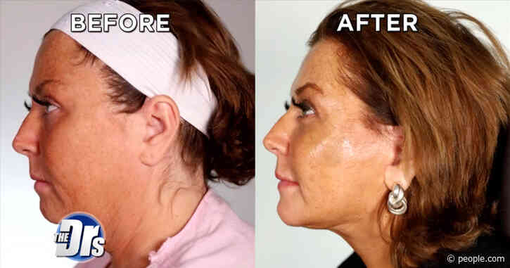 Abby Lee Miller Reveals Results of Her Neck and Facelift on The Doctors: 'I Don't Like Needles'