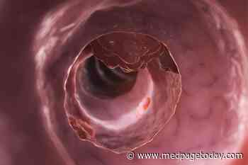 Bloody Stool With Oral Anticoagulation: Don't Keep Calm and Carry On