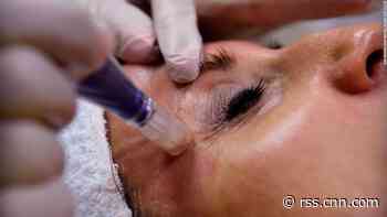 Plastic surgery inspired by filters and photo editing apps isn't going away