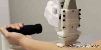 This robot excels at drawing human blood     - CNET